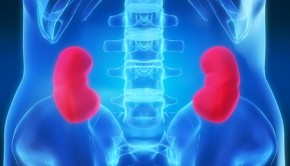 kidney-pain