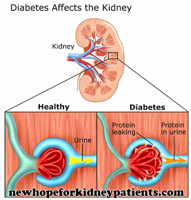 diabetes-kidney-1