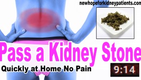 how to kidney stones