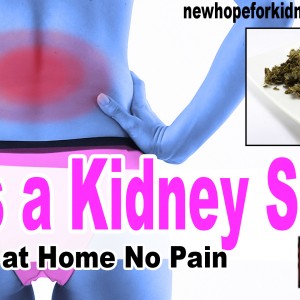 how to kidney stones